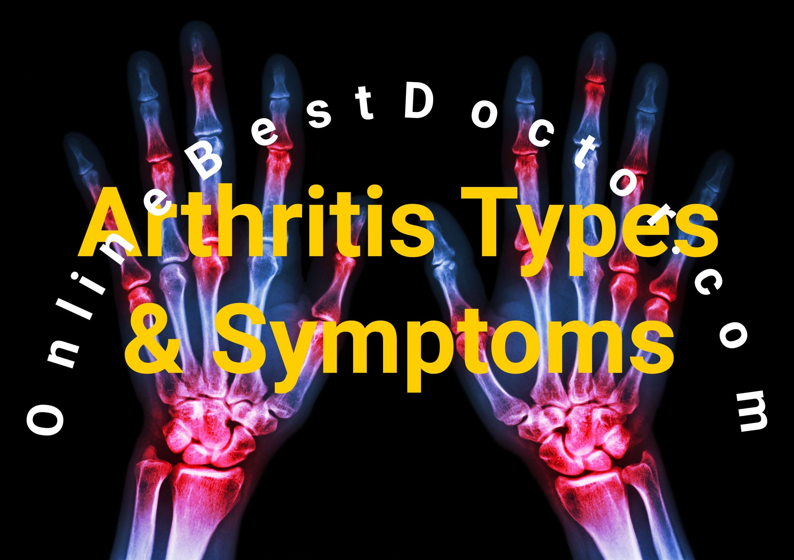 Arthritis Types and Symptoms