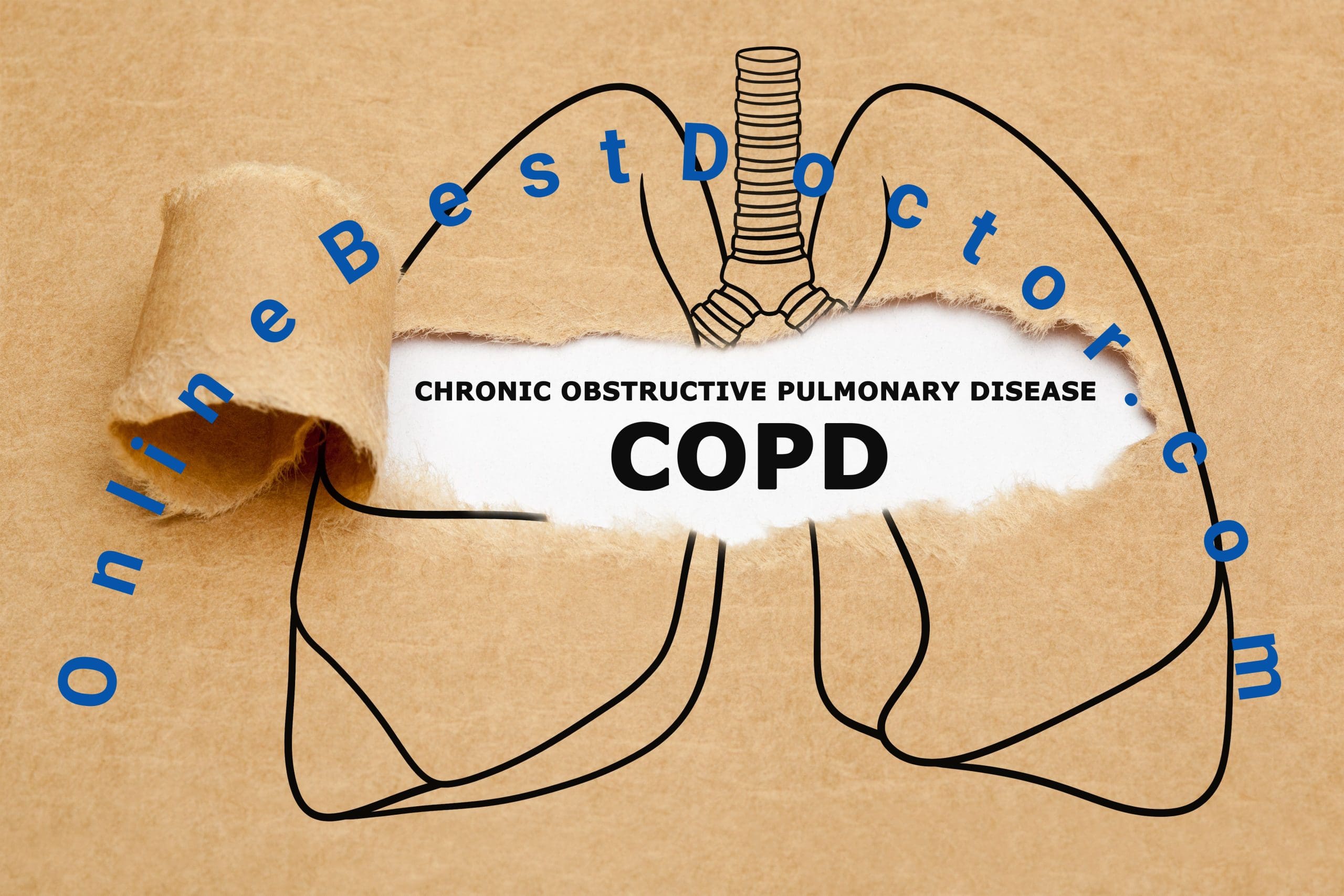 Chronic Obstructive Pulmonary Disease