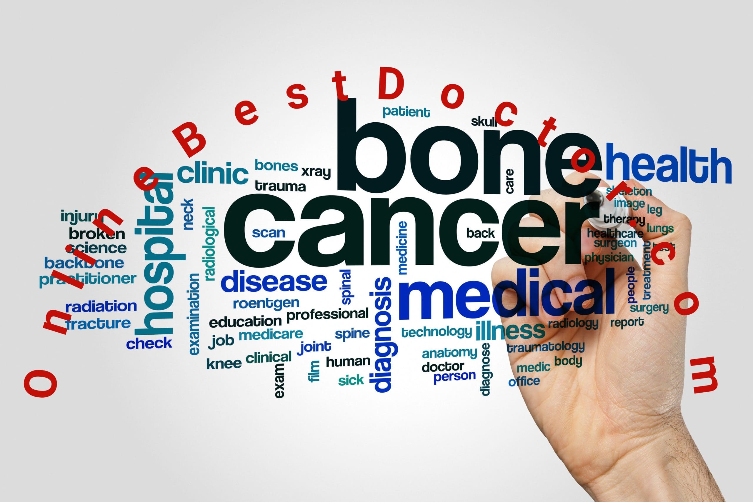 Bone Cancer Causes and Treatment